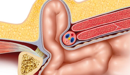Was Sie über Hernien wissen sollten